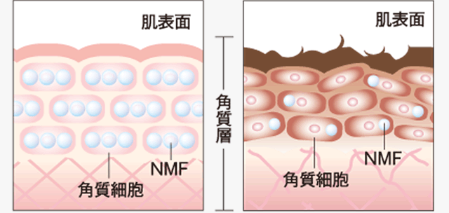 「NMF」が満ち足りている肌/「NMF」が不足している肌 