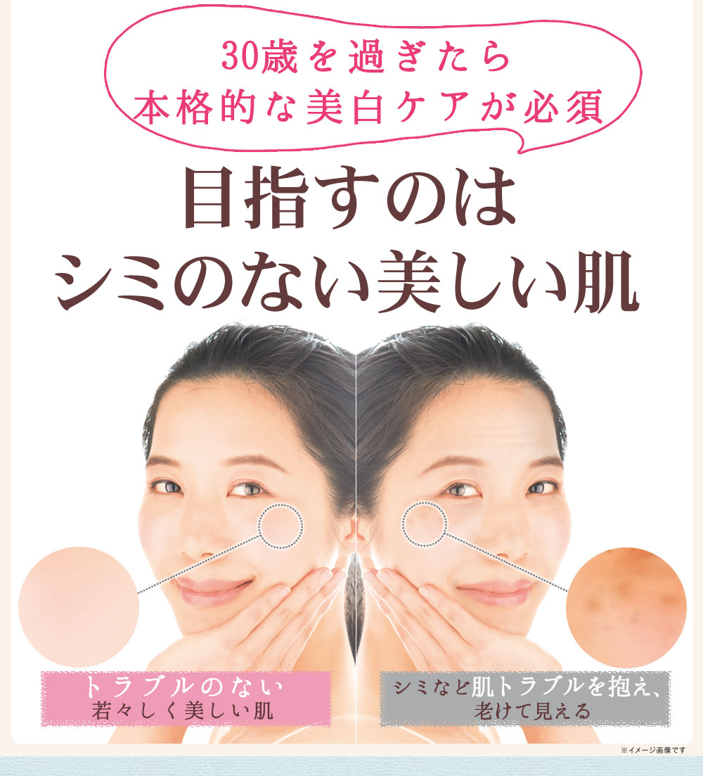 目指すのはシミのない美しい肌