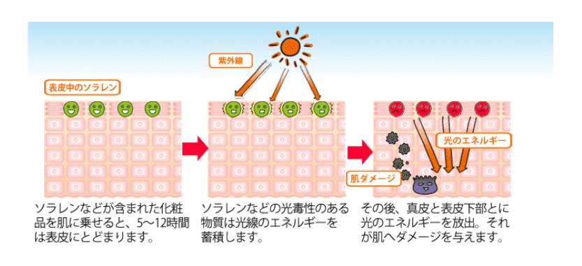 ソラレンの説明