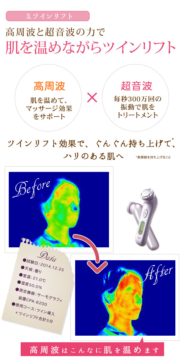 3.ツインリフト
