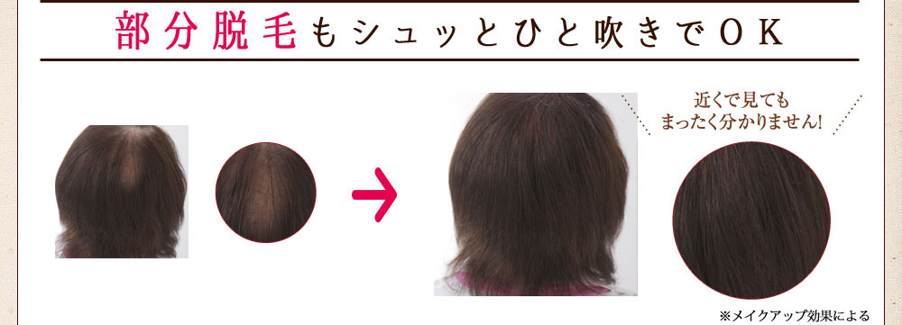 部分脱毛もシュッとひと吹きでＯＫ