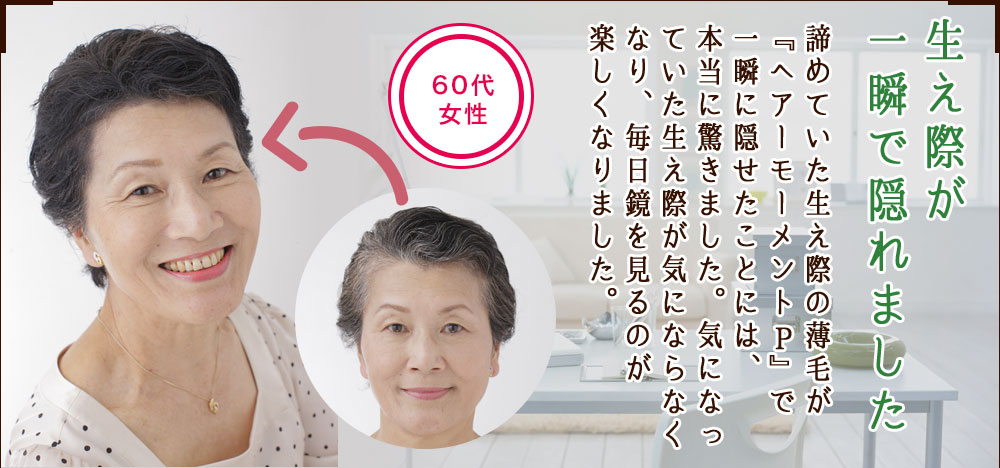 生え際が一瞬で隠れました