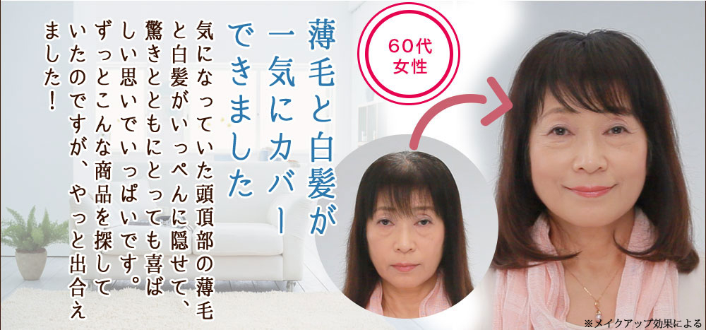 薄毛と白髪が一気にカバーできました