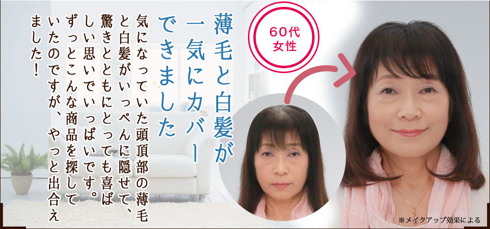 薄毛と白髪が一気にカバーできました