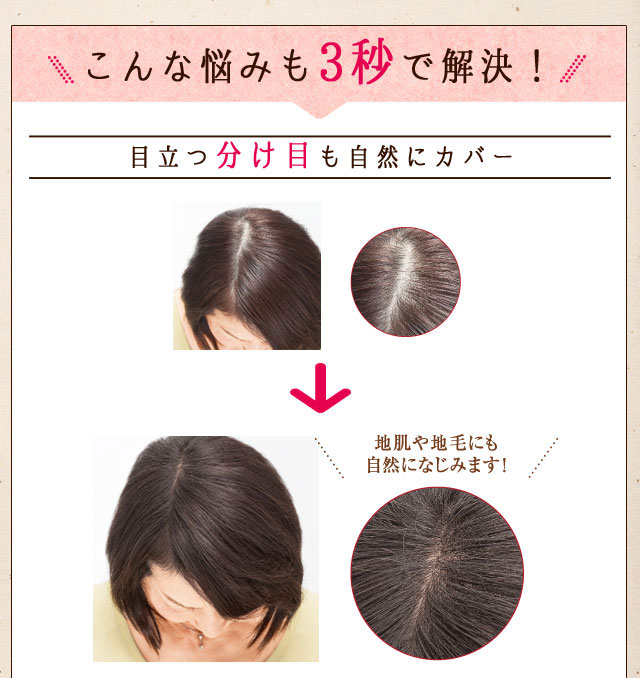 3秒で薄毛・白髪・分け目をカバー！ 髪に悩んだらまずは『ヘアーモーメントP』｜美顔器・原液のEBiS化粧品