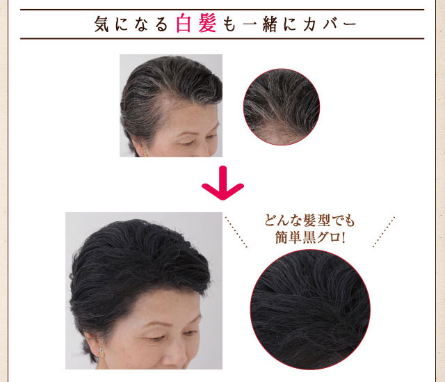 3秒で薄毛・白髪・分け目をカバー！ 髪に悩んだらまずは『ヘアーモーメントP』｜美顔器・原液のEBiS化粧品