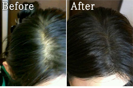 3秒で薄毛 白髪 分け目をカバー 髪に悩んだらまずは ヘアーモーメントp 美顔器 原液のebis化粧品