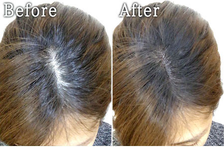 3秒で薄毛・白髪・分け目をカバー！ 髪に悩んだらまずは『ヘアー