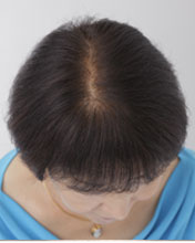 (50代女性)