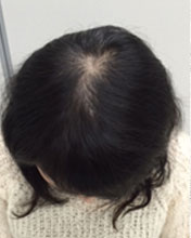 (40代女性)