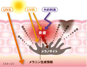トラブルが起きる原因