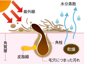 (例1)黒ずみ毛穴