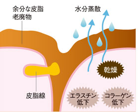 (例2)たるみ毛穴