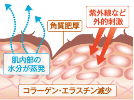 トラブルが起きる原因