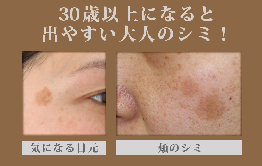 薬用美白原液〈エビス ビーホワイト〉待望の新発売！