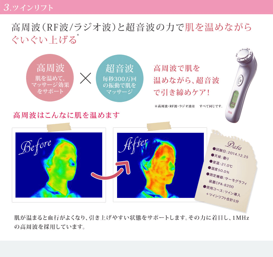 3.ツインリフト
