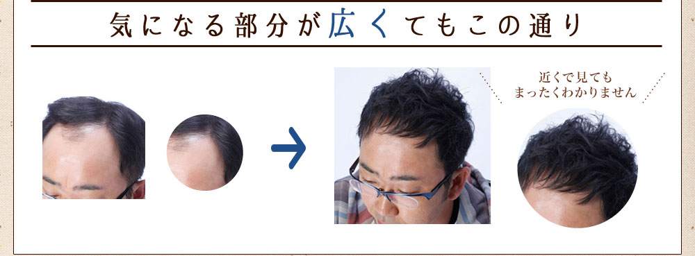気になる部分が広くてもこの通り