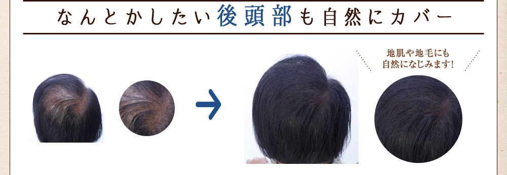なんとかしたい後頭部も自然にカバー